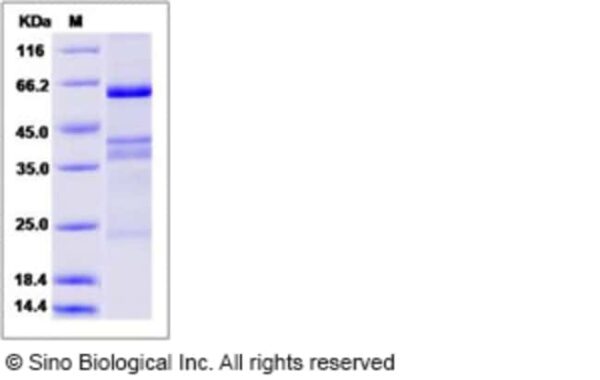 Sino Biological Human EGFL6 / EGF-L6 Protein (His Tag) 500ug