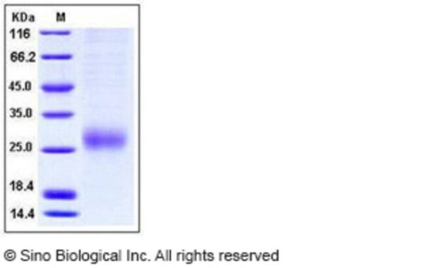 Sino Biological Human ALK-1 / ACVRL1 Protein (His Tag) 1mg