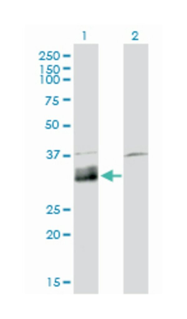 DNASE1L1, Mouse, Clone: 4E8, Abnova