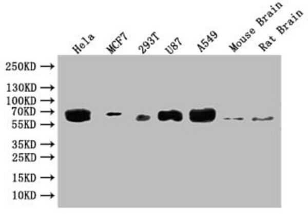 Glucosylceramidase/GBA Antibody (4H4), Novus Biologicals