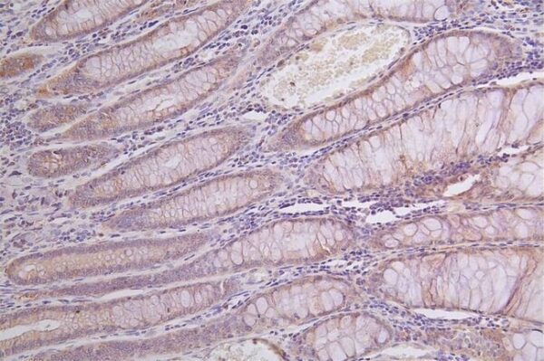 alpha-Galactosidase A/GLA Antibody (30H11), Novus Biologicals