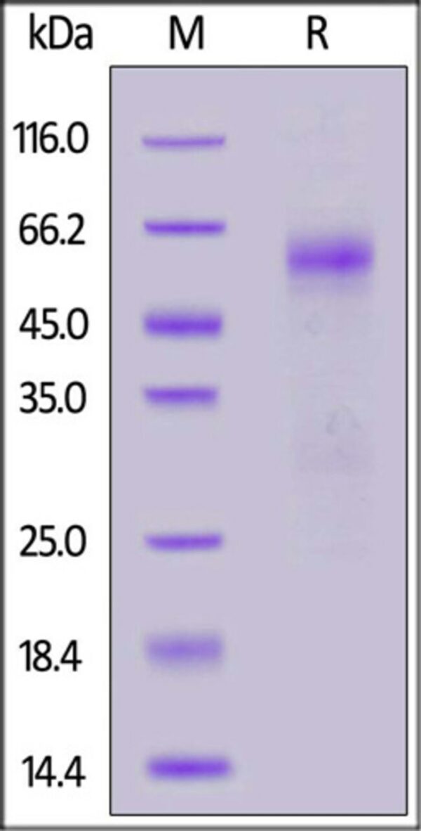 ACROBiosystems ACROBiosystems SARS-CoV-2 Nucleocapsid protein (T205I), His Tag