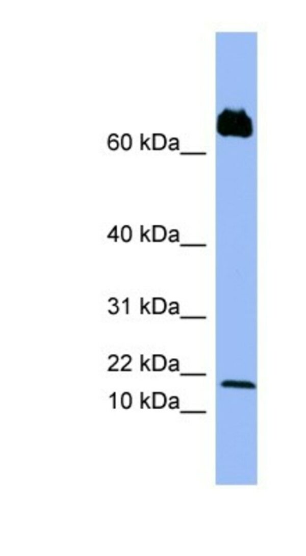 CXCL4L1 Antibody, Novus Biologicals