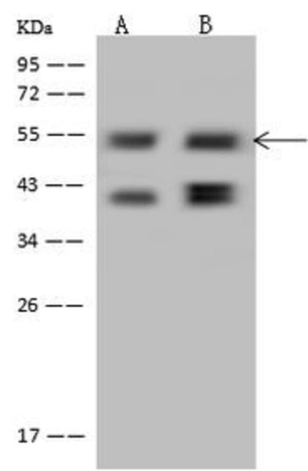 PPHLN1 Polyclonal Antibody, Invitrogen