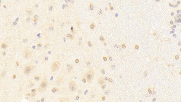 PCDHA1 Polyclonal Antibody, Invitrogen