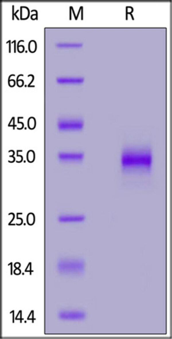 ACROBiosystems ACROBiosystems Biotinylated SARS-CoV-2 S protein RBD (N501Y), His,Avitag (MALS verified)