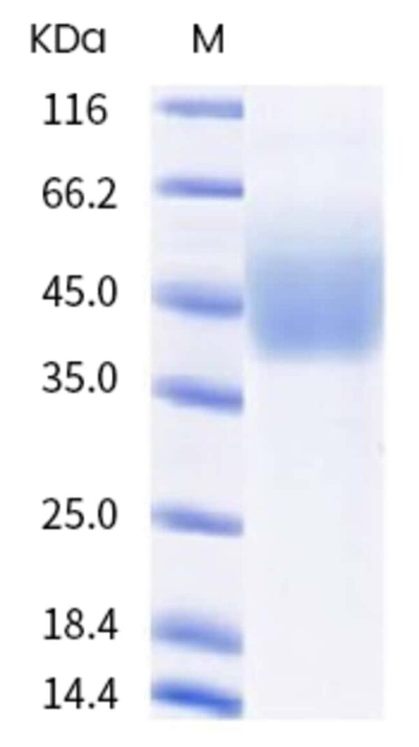 Sino Biological Human NCR3LG1 Protein 100ug (Sino Biological)