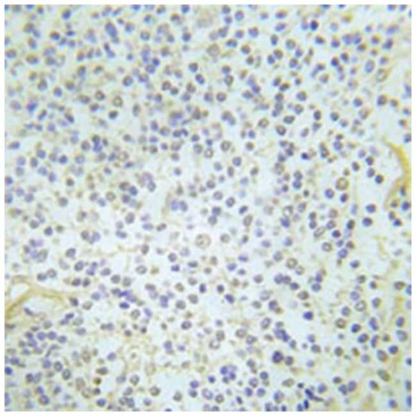 ABL1 (phospho Y204), Rabbit anti-Human, Mouse, Rat, Polyclonal Antibody, Abnova