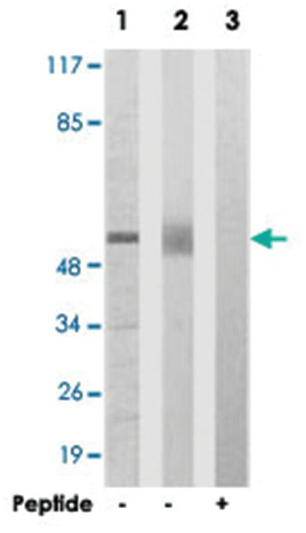 ACVR1B Rabbit anti-Human, Mouse, Rat, Polyclonal Antibody, Abnova