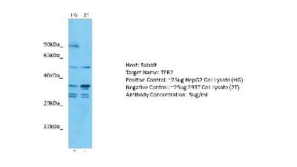 TfR2 Antibody, Novus Biologicals