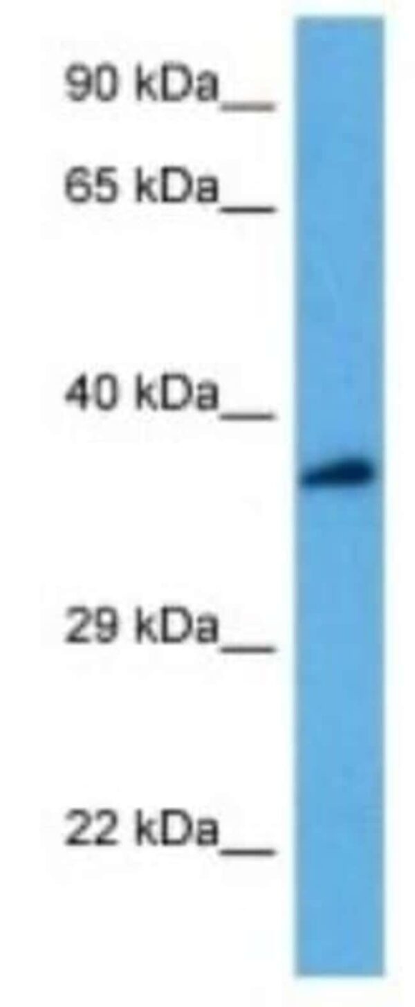 ATP6V0D2 Rabbit anti-Mouse, Polyclonal, Novus Biologicals