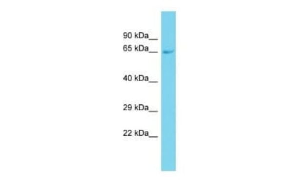 GRB 14 Rabbit anti-Rat, Polyclonal, Novus Biologicals